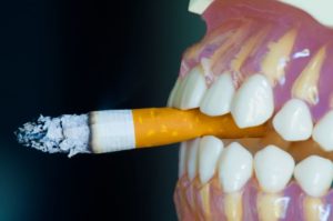 dientes-de-personas-que-fuman