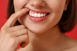 recesion-gingival