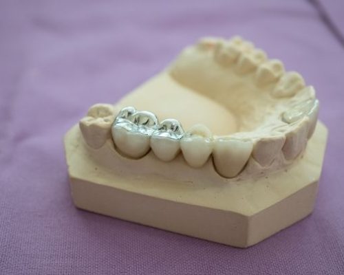 relleno-dental